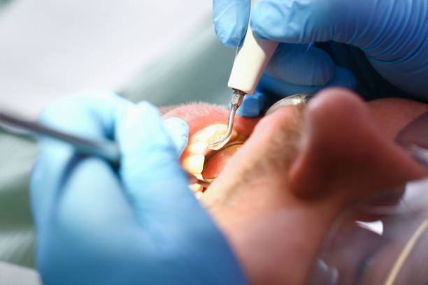Best Cosmetic Emergency Dentistry in West Jefferson, OH
