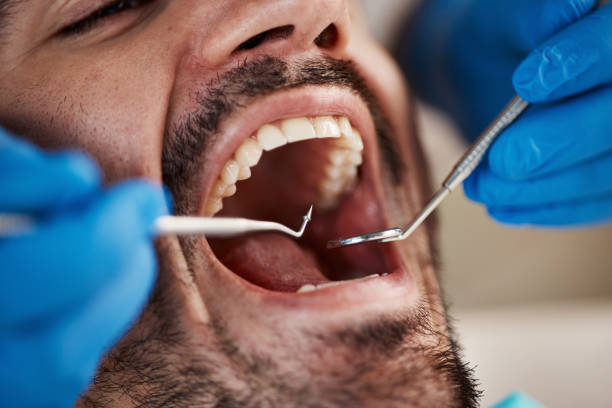 Best Emergency Tooth Extraction in West Jefferson, OH