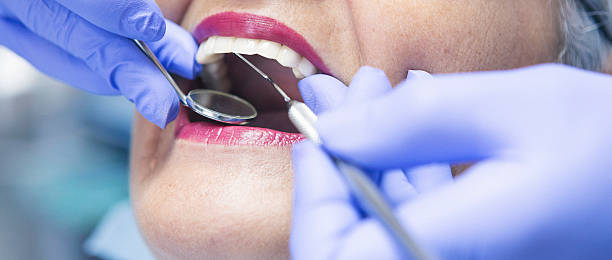 Best Emergency Treatment for Dental Infections or Abscesses in West Jefferson, OH